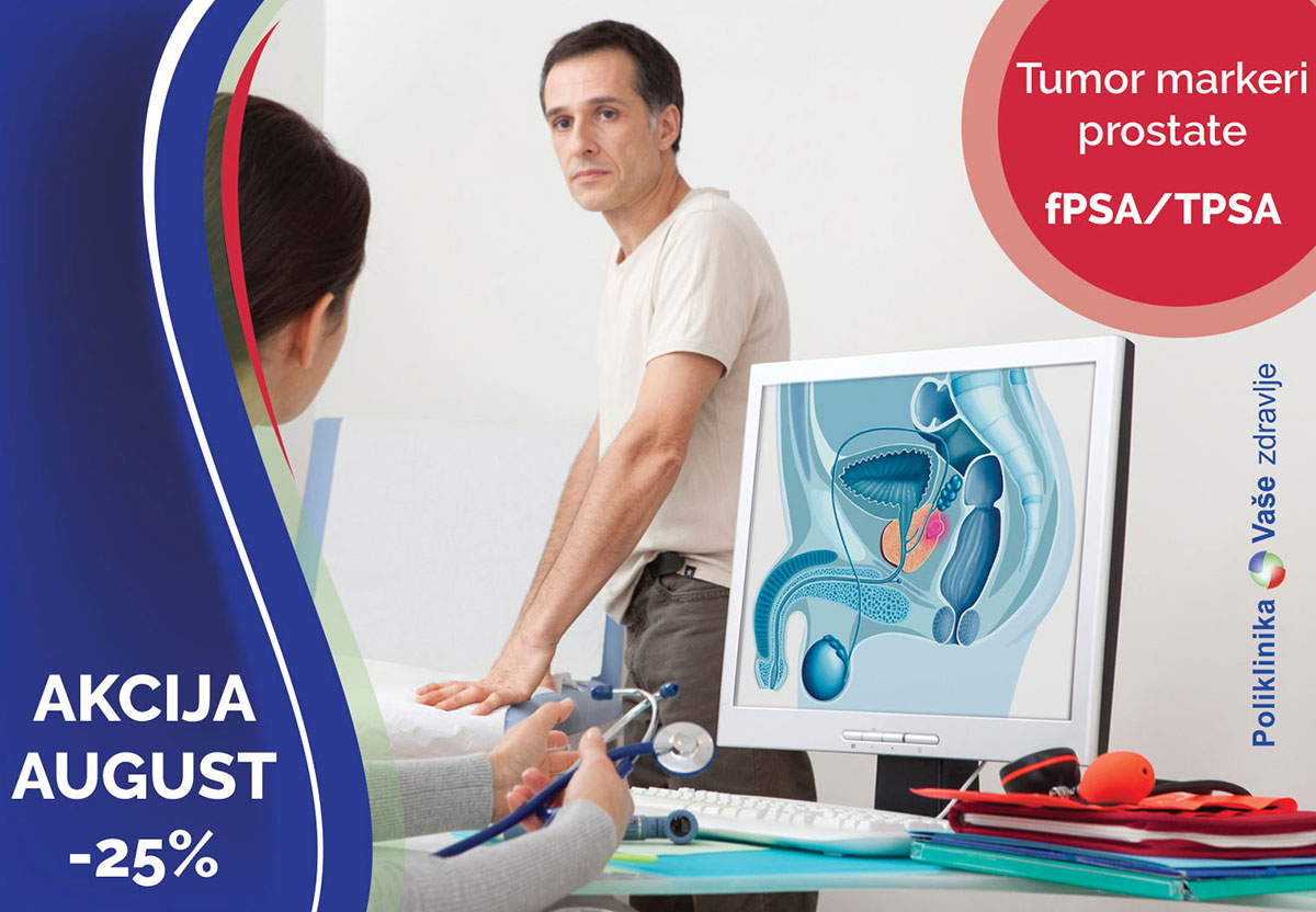 Tumor markeri prostate fPSA i TPSA