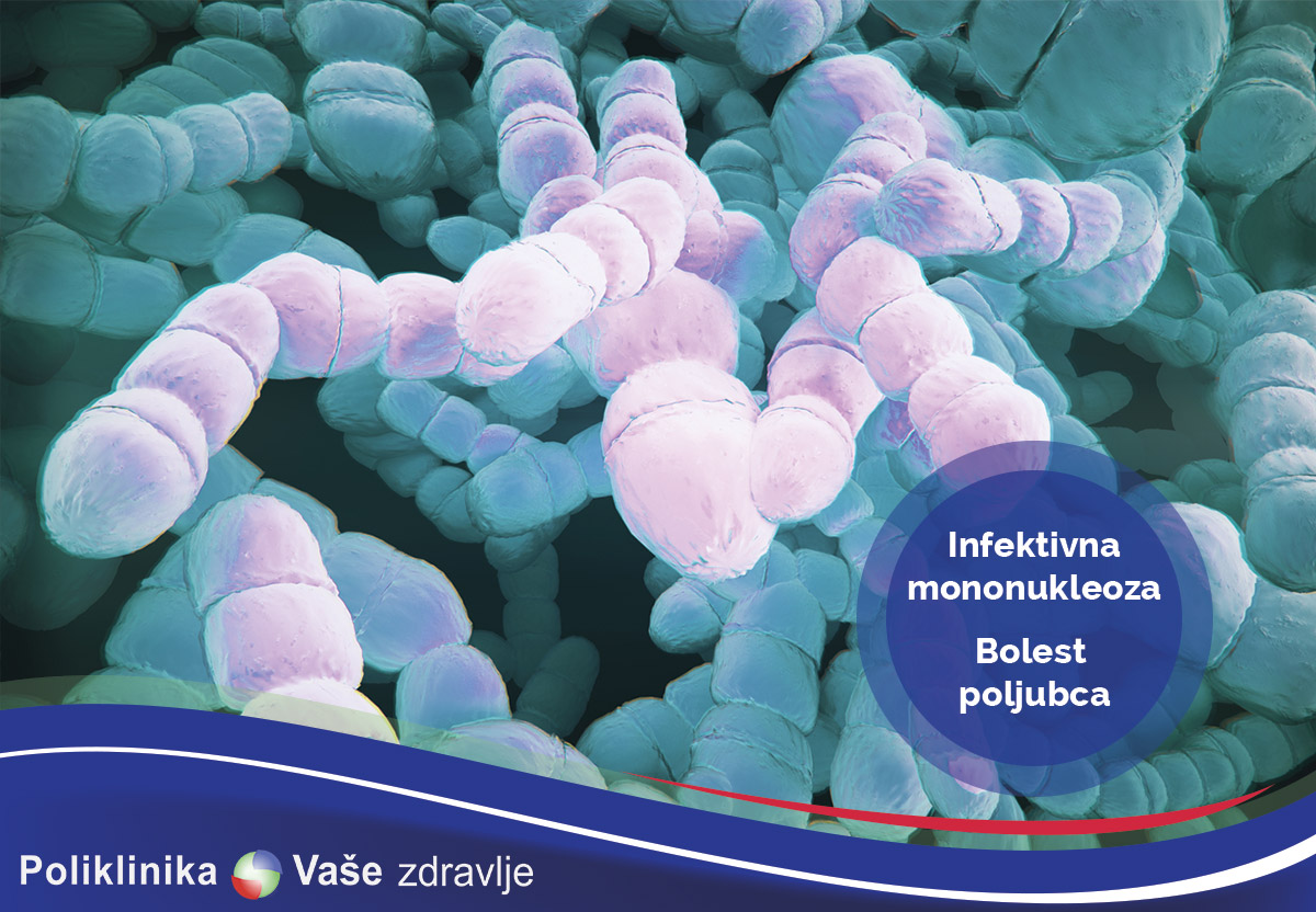 Infektivna mononukleoza ili bolest poljubca